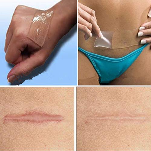 Silicone scar patch