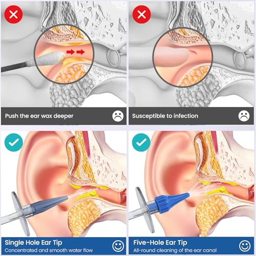 Ear Syringe - Ear Wax Removal - Sucks Snot and Earwax Removal Kit - FSA HSA Eligible-Safe and effective removal of ear wax and snot