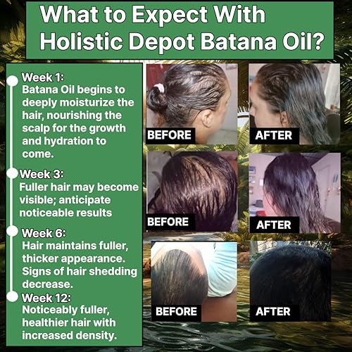 Batana-Oil-The-Honduran-Miracle-Oil-For-Hair-Growth-and-Skin-Care-100-Pure-and-Authentic-Batana-Oil-16-Oz-454G