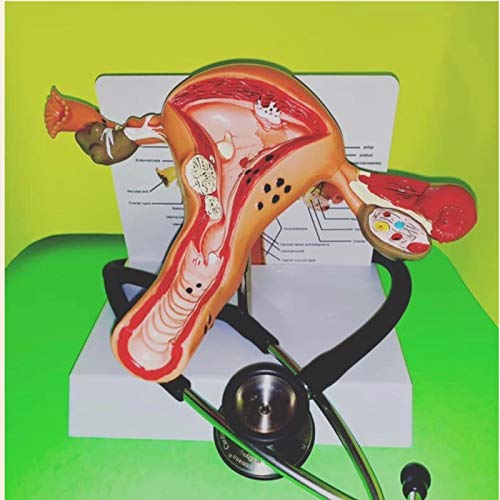 Vaginal Yeast Infection It Sure Looks Like Cottage Cheese! Amazon.co