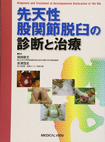 無料電子書籍 おすすめ 先天性股関節脱臼の診断と治療 バイ