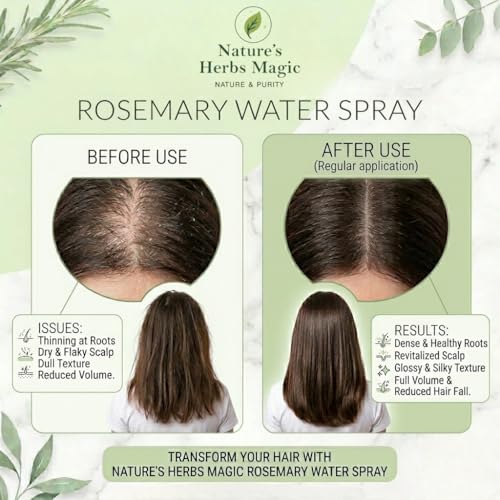 Image of Nature's Herbs Rosemary Hair Spray with Natural Rosemary Water | Hair Growth & Scalp Care Spray | Anti Hair Fall Hair Strengthening Herbal Tonic | Suitable for Men Women | Pack of 2 (100 ml Each)