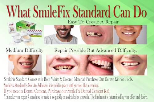image for SmileFix Standard Dental Repair Kit - Color Matching Compound - For Mi