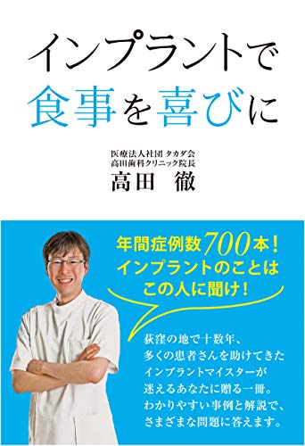 オライリー 無料電子書籍 インプラントで食事を喜びに バイ