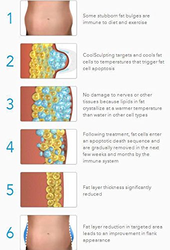 The Ultimate Shape-N-Freeze Body Sculpting Fat Freezer System