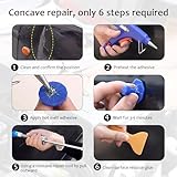 Zoom IMG-2 roinaid dellen kit di riparazione Zoom IMG-2 roinaid dellen kit di riparazione