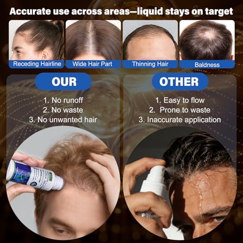 Image of 3 Pack 5% Minoxidil for Men and Women,Minoxidil Beard and Hair Growth Serum(Biotin-Infused) with Sponge Applicator for Thinning Hair and Sparse Beards,4-Month Supply 3 x 2.7 FL OZ