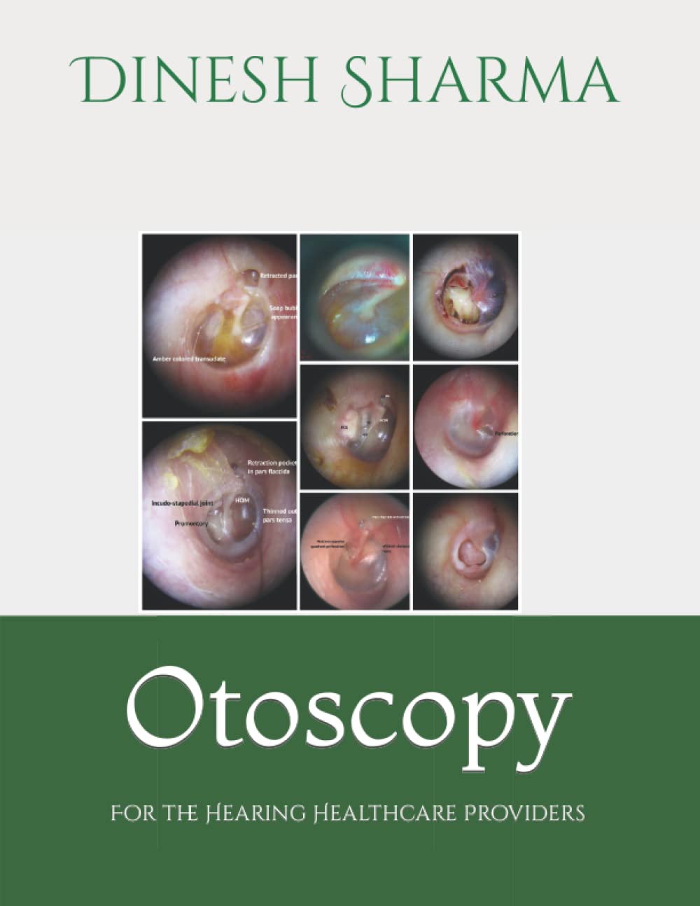 Otoscopy: For the Hearing Healthcare Provider
