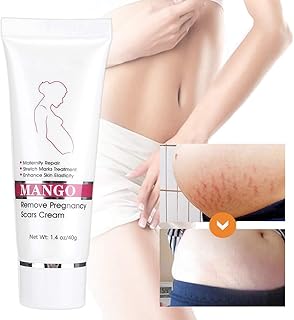 Stretch Marks and Scars Defense Cream, Stretch Mark Cream Stretch Mark Removal Cream Stretch Mark Treatment Maternity Repair - Ideal Pregnancy Belly Cream - 1.4oz