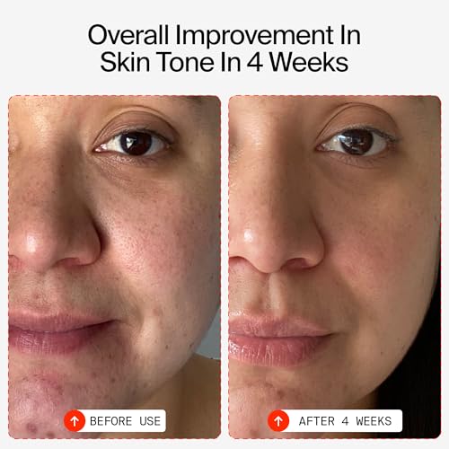 Youth To The People 15% Vitamin C + Caffeine Energy Face Serum, Reduce Puffiness, Brighten Uneven Skin Tone + Improve Texture, Treats Dark Spots + Dullness, Vegan - Image 5