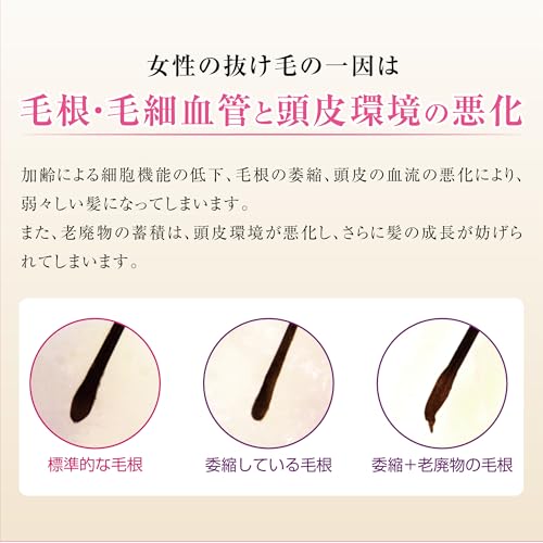 加美乃素 レディス加美乃素EX 150ml