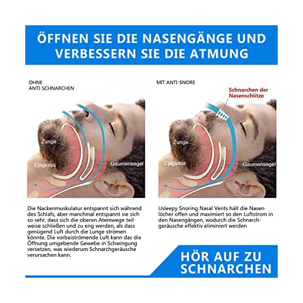 Schnarchstopper, Anti Schnarch, Anti Schnarch Nase Schnarchen Stopper, Nasal Dilatator Schnarchen Schnarchen Clip… – Bild 4
