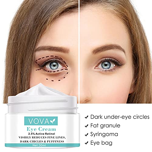 Mimei 30ml natuurlijke fijne lijnen oogcrème anti veroudering effectieve onmiddellijke rimpel Corrector veilige oog… - Afbeelding 4