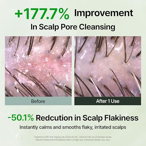 Image of GROWUS Algae Therapy Seaweed Shampoo (16.9 Fl Oz) 500ml | Marine Peptide, Biotin & Salicylic Acid | Volumizing & Scalp Strengthening Wash for Fuller Looking Hair | Korean Hair Care