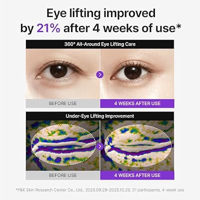 Centellian24 360 Shot PDRN Firming Eye Cream 30ml (1.01 fl oz) Anti-Aging Retinol Eye Cream for Hooded Eyes, Wrinkle Smoothing, Firming Hydrating Care for Under-Eye Bags, Crows Feet & Dark Circles