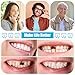 TrelaCo 16 Pcs Dentures DIY Repair Kit Fake Teeth Kit Make Your Own Dentures Kit Repair Missing Teeth Easy and Convenient Customizable Denture Solution for Improve Smile