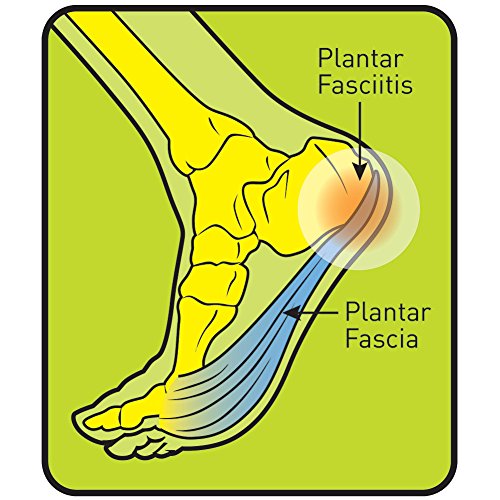 ProFoot Heel Pain & Plantar Fasciitis, Women's 6-10 1 Pair (Pack of 4)