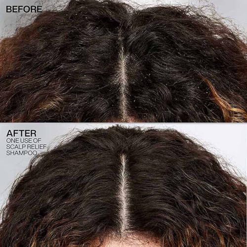 Image of Redken Scalp Relief Anti-Dandruff Shampoo, 250 ml | Dermatologically tested pH-balancing Shampoo with Pyrithione Zinc. Soothes itchy scalp and helps control dandruff.