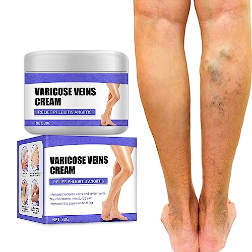 Tkekruh Venas Varicosas En Las Piernas,Crema Para Las Varices,Spider Vein Cream,Crema Adecuada Para Venas,Spider Leg Repair Cream,Crema De Venas Varicosas Para Piernas Mejorar La Circulación Sanguínea