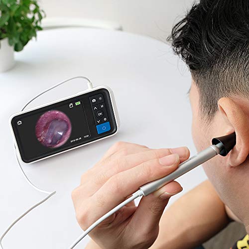 Digital Otoscope With 4.5 Inches Screen, Anykit 3.9Mm Ear Camera With 6 Led Lights, 32Gb Card, Ear Wax Removal Tool, Specula And 2500 Mah Rechargeable Battery, Supports Photo Snap And Video Recording #TOP6