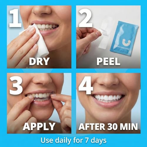 Image of Teeth Whitening Strips for Sensitive Teeth - Peroxide Free No Sensitivity - 14 Strips with Pap+ & Nano Hydroxyapatite - Enamel Safe Whitening in 7 Days - WhiteU