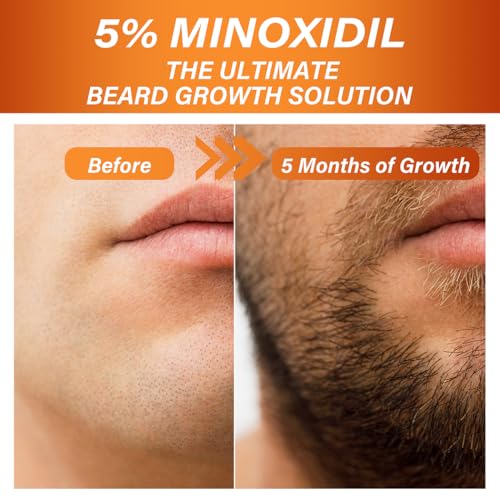 5% Minoxidil Beard Growth Serum for Men, 5% Minoxidil Hair Regrowth Roller Bottle Design, Extra Strength Beard Growth Oil for Stronger Thicker Fuller Beard Faster - Image 5