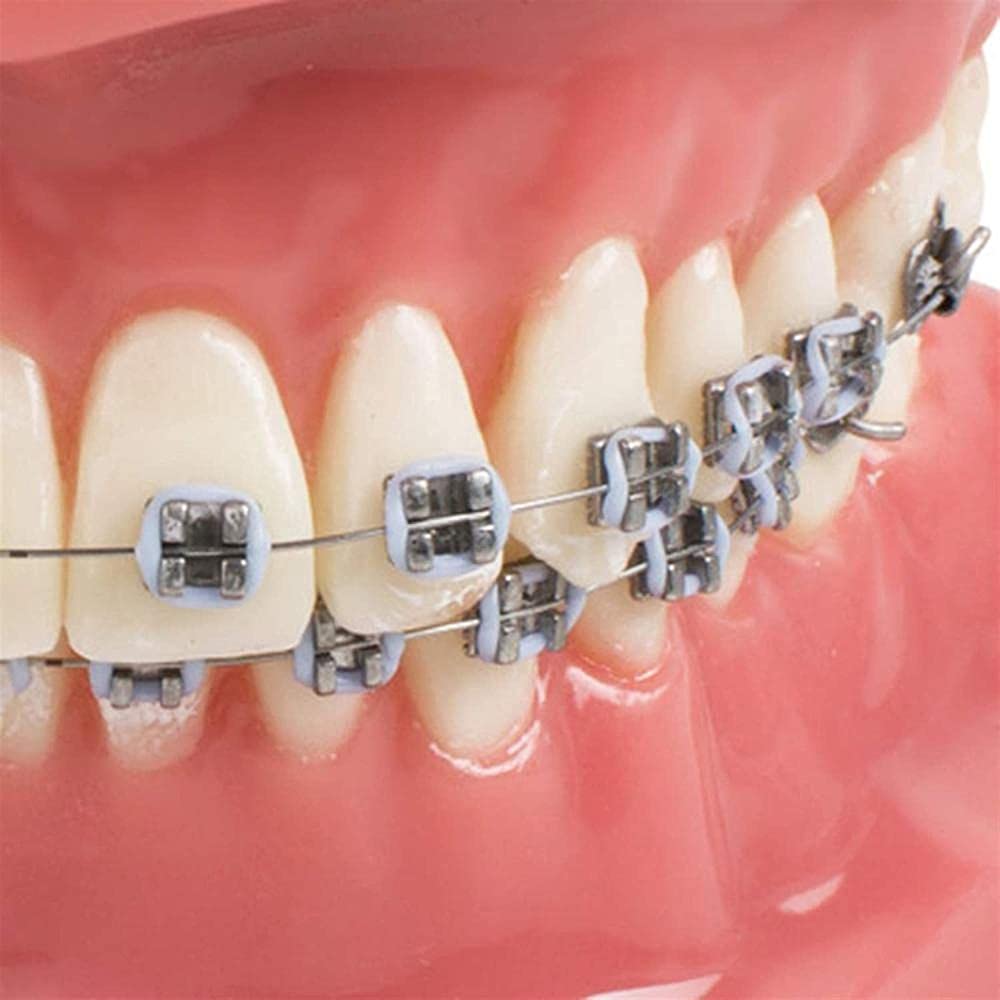 NaoSIn-Ni Model do nauki model zębów dentystyczne malokluzja ortodontyczne leczenie l nauka zębów do nauki 1 szt. medyczne narzędzie do nauki zabawka