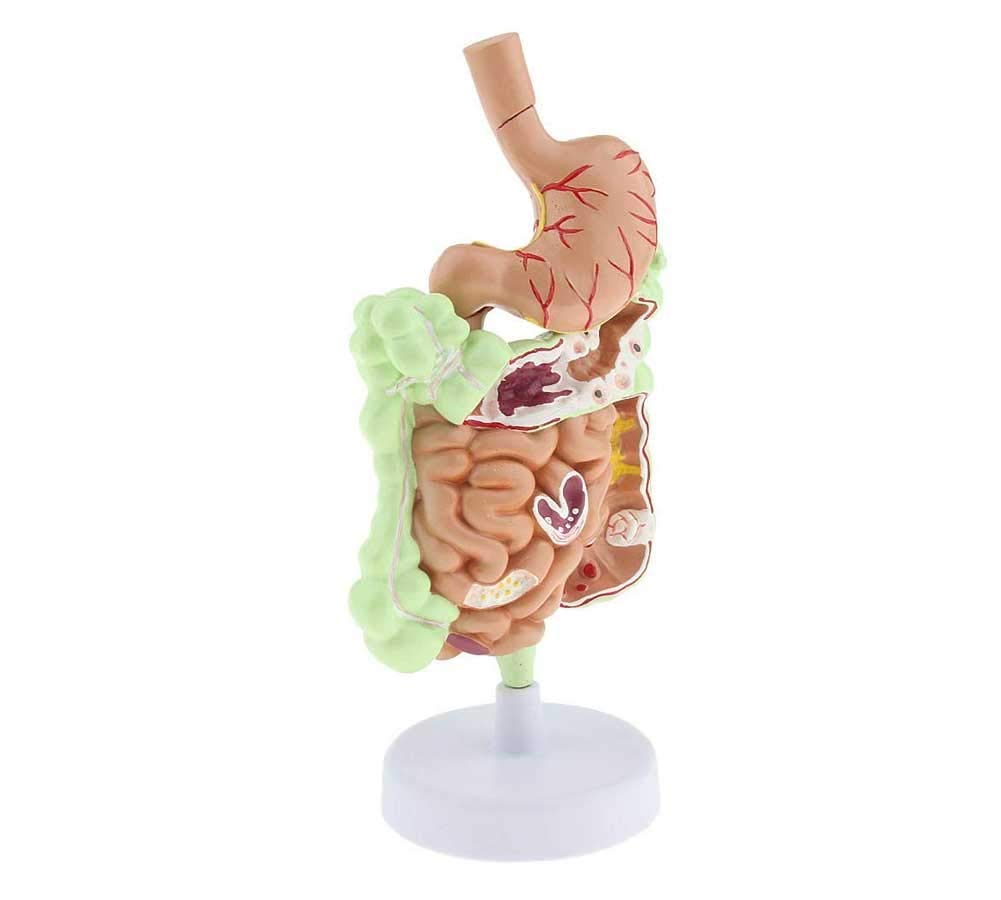 Anatomia patologiczny model ludzkiego okrężnicy model żołądkowo-jelitowy Des digestive do szkoły badania anatomiczne wyświetlacz model szkieletu