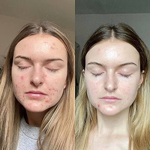 K6 Skin Care Retinol Gel 0.1 Vitamin A Repairs Fine Lines & Wrinkles, Scar Treatment, Age and Sun Spots, Anti-Aging Formula Gel 20 Grams