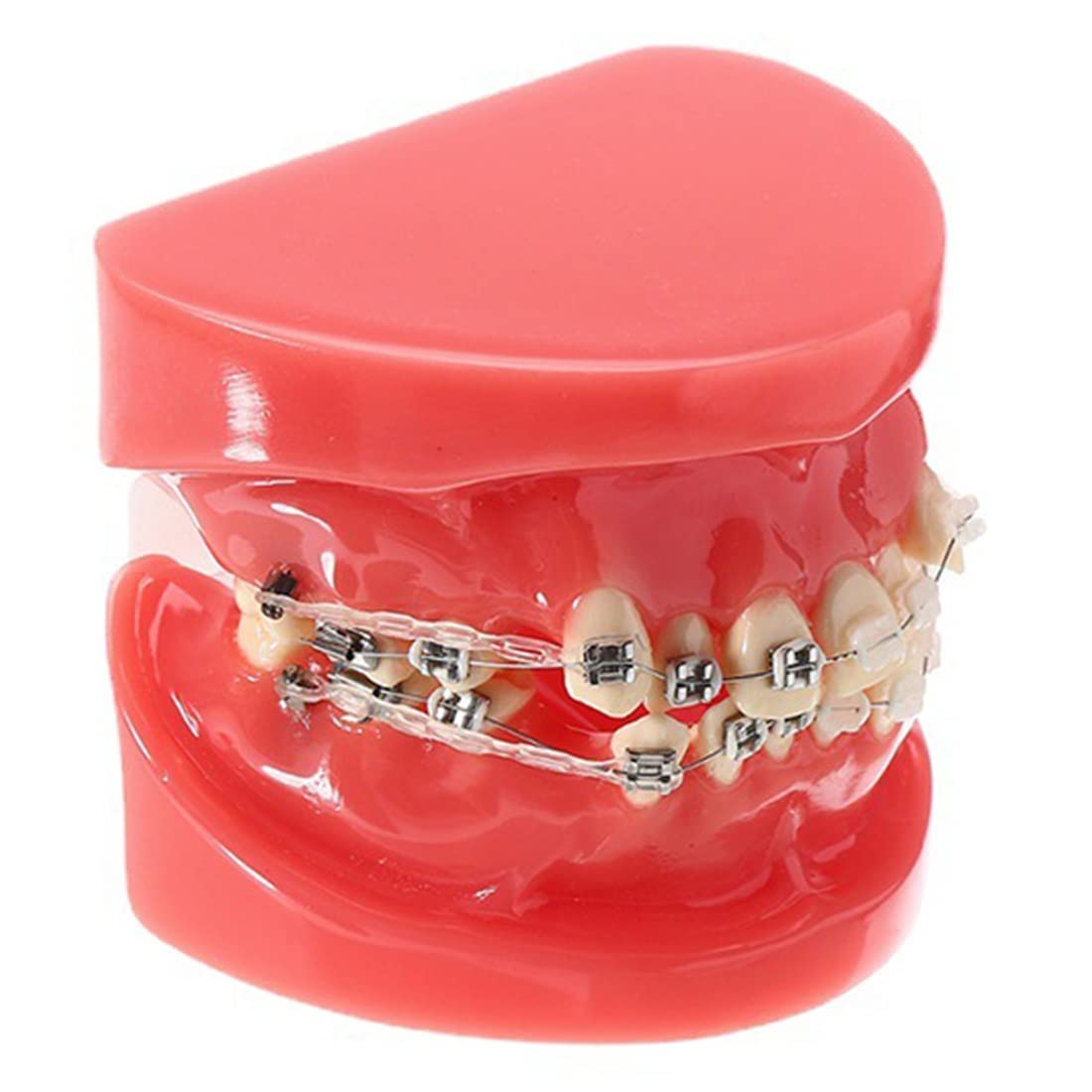 Kieferorthopädisches Demonstrationsmodell für Zahnzähne mit Ligaturbändern, Metall- und Keramikbrackets, Typodont Lehren, Studieren, Erklärmodell
