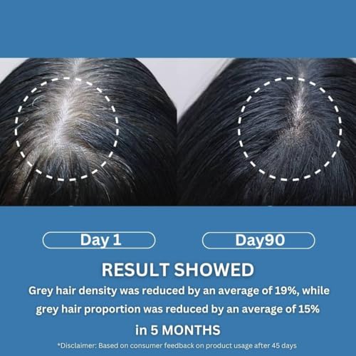 Image of Anti Grey Hair Serum with 2% Darkenyl | Hair Growth Actives with Biotin, Bhringraj, Henna & Amino Acid Complex | Strengthens Roots & Adds Shine | Toxin Free | All Hair Types 30ml