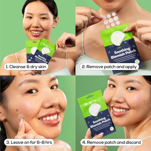 Tratamiento hidrocoloide para granos antes de la etapa e imperfecciones inflamadas HANHOO 7