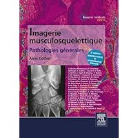 Imagerie musculosquelettique