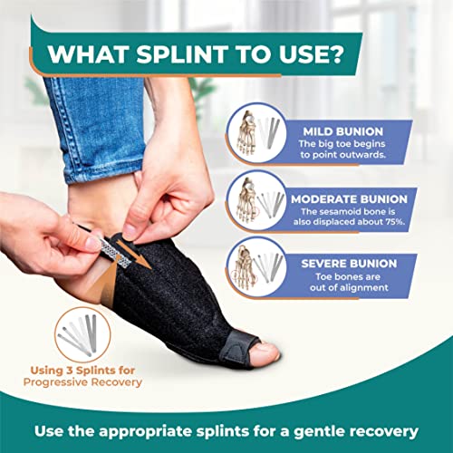 Nypot Bunion Corrector For Women With 3 Bunion Splints – Bunions Correction Women Big Toe Straightener And Toe Separator For Bunion Relief – Bunion Socks -Hallux Valgus Bunion Pads For Day & Night Use #TOP1