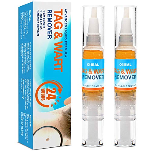 Oheal Effective Formula Skin Tag Remover and Wart Remover For You