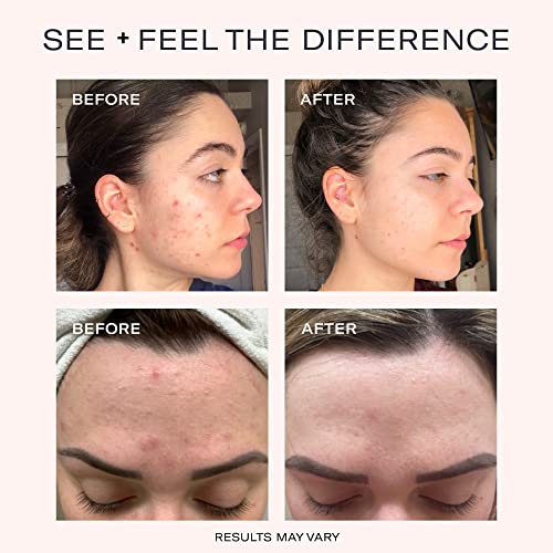 Odacité Face Serum & Acne Mask, Pore Cleanser Facial Oil For Skincare - Bl+C, Black Cumin & Cajeput Glow Recipe - Purifying Facial Serum With Vitamin A & Natural Ingredients - 0.17 Fl. Oz #TOP4