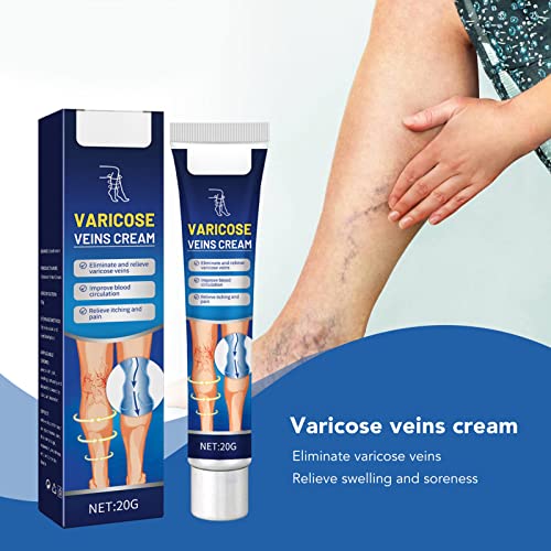 Crema per le Vene Varicose, Vene Varicose e Crema