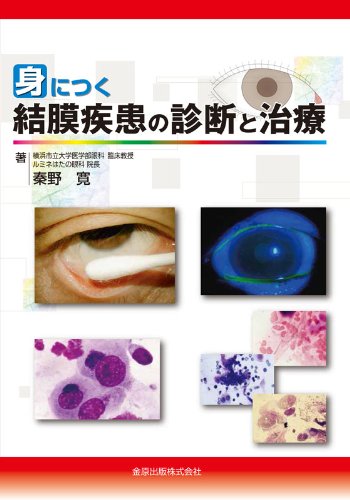 身につく結膜疾患の診断と治療 身につく結膜疾患の診断と治療