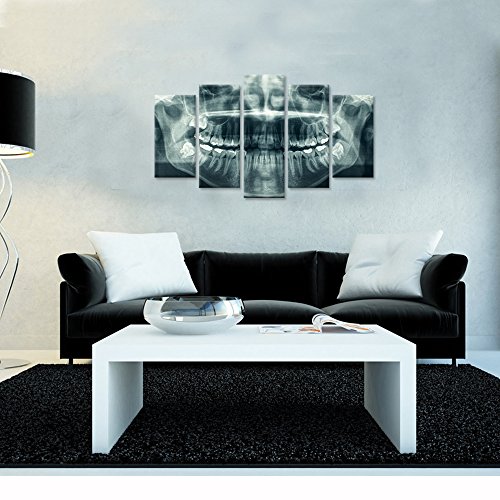 Ihappywall Modern 5 Panel Canvas Wall Art X-Ray Dental Tooth Oral Panoramic The Picture Teeth Decay Print For Dental Room Stretched And Framed For Living Room Ready To Hang #TOP3