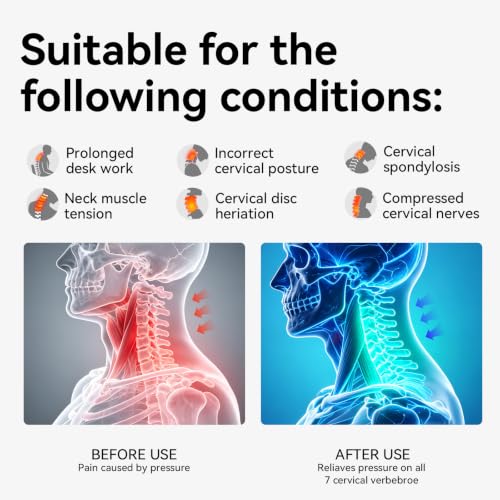 Neck Posture Corrector with Rear Neck Support（Gray, X-Large） Alternate view