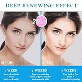 Sikeydels B0F9WV7CRH lato 4