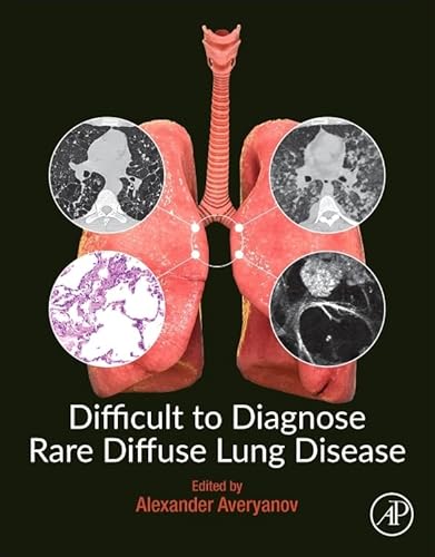 Difficult to Diagnose Rare Diffuse Lung Disease