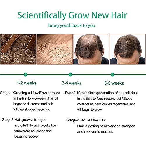Hair Growth Serum, Hair Care Product, Hair Serum, Fast Hair Growth, Hair Growth & Hair Thickening,Stop Hair Loss, Grow Hair Fast, Hair Loss Treatment for Men & Women(30ml) - Image 7