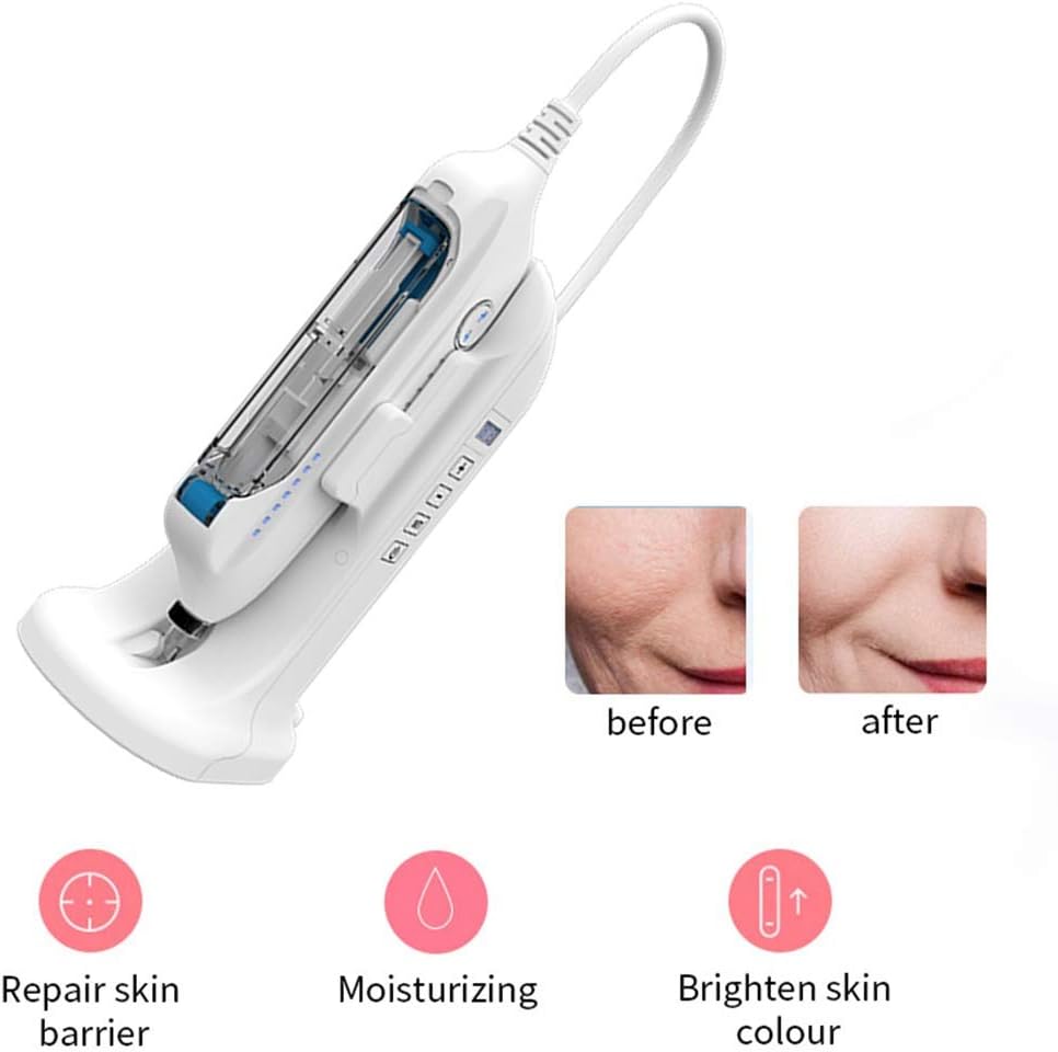 microdermoabrasione a casa macchina