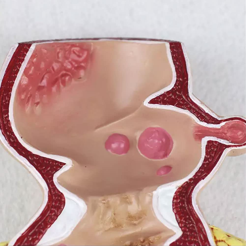 Model Odbytnicy Człowieka Odbytnicy Model Powiększenia Zmian Patologicznych Model Rozszerzenia Układu Trawienia Anatomia-Modele Medyczne Materiały Edukacyjne