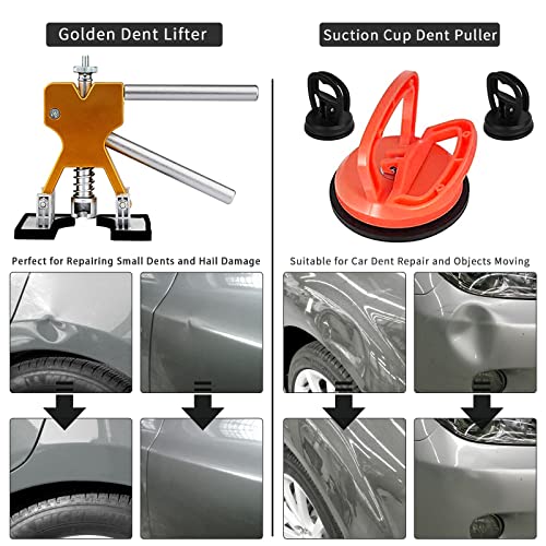Dopke YHC-PDR-001 97Pcs Dent Puller Kit, Dent Removal Kit For Dent Repair thumb #5