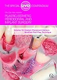 Plastic-Esthetic Periodontal and Implant Surgery, Volume 10: Implant Placement Using a Modified Roll Flap Technique