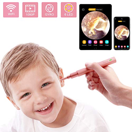 Ear Camera, 1080P FHD Wireless Ear Wax Removal Endoscope, Super Light Lens WiFi