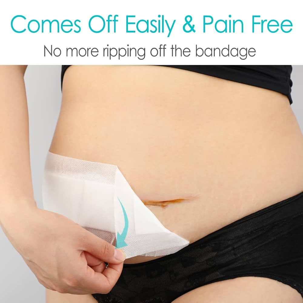 Amazon.com: 10 Pcs C-Section Incision Adhesive Island