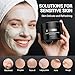 Clay Mask & Mud Face Mask – Purifying Kaolin Clay Mask, Blackhead Remover & Oil Control for Sensitive, Oily & Dry Skin | Detoxifying Pore Cleanser & Scrub | Helps Reduce Pores & Acne | 10.5 oz